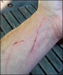 Name:  cat-scratch.jpg
Views: 747
Size:  18.5 KB